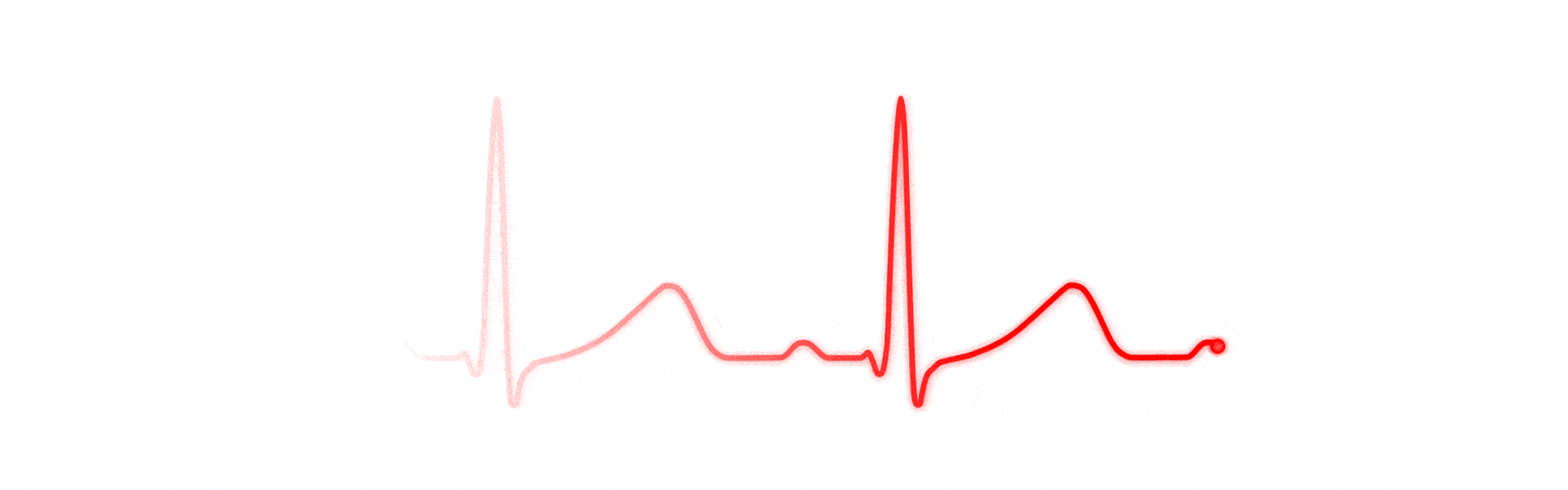 pulse